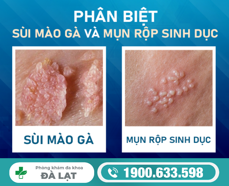 Hình ảnh minh họa